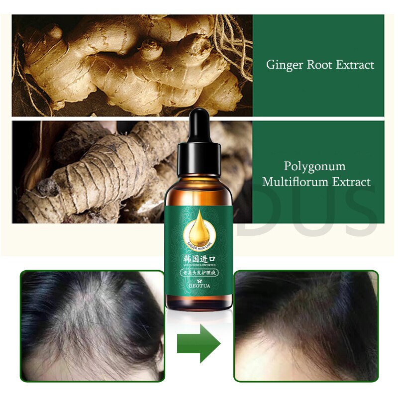 Ginger For Hair Care Treatment Essence Fast Powerful Hair Growth Liquid Hair Loss Products Serum Repair Keratine Herbal 30ml